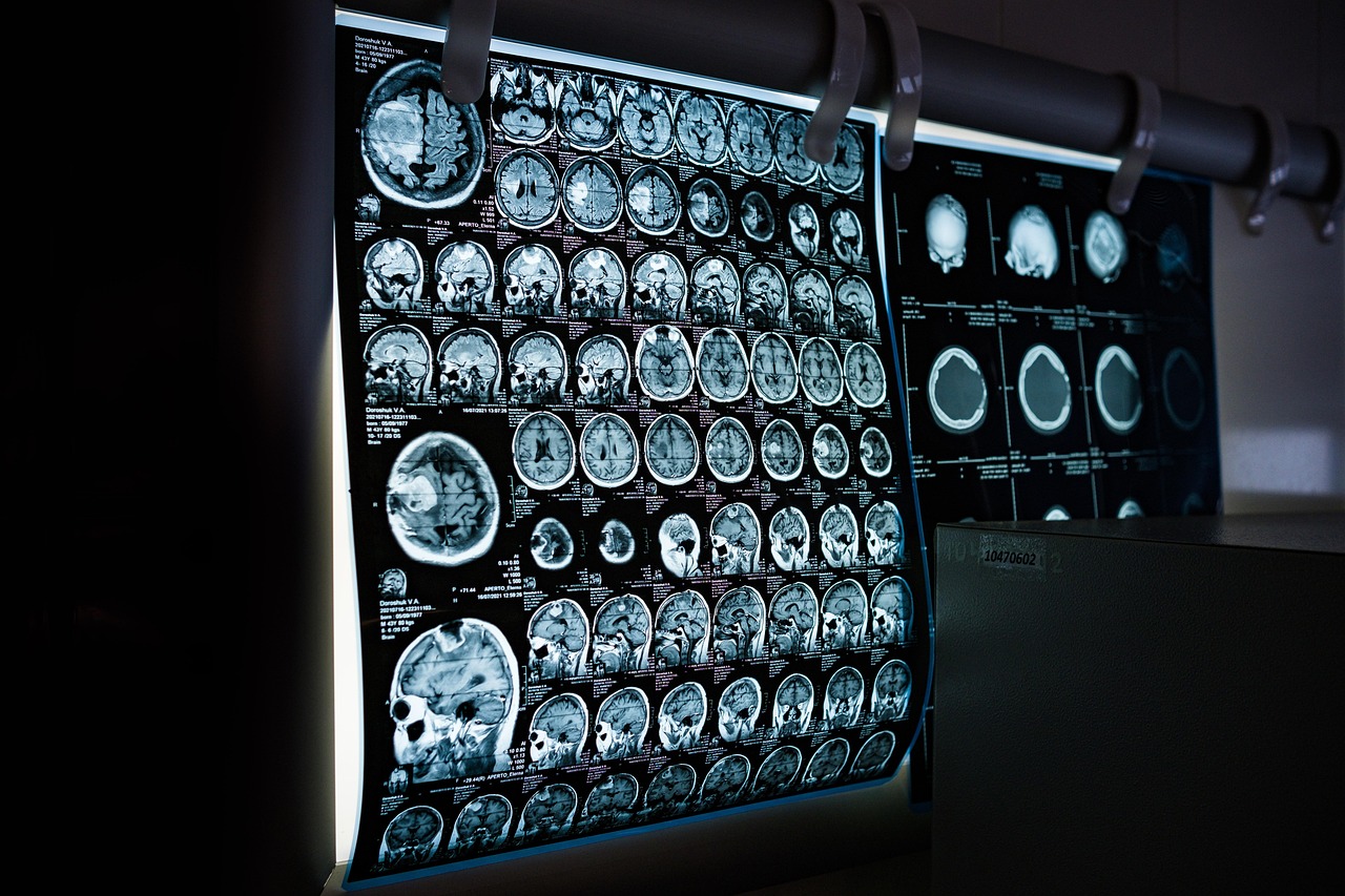 Ein Labor für Gehirntumor Forschung mit Monitor für Hirnscans und Bestrahlungsgerät im Hintergrund – Foto: Mitrey / Pixabay